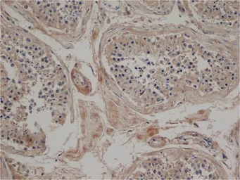 Anti-Jagged 2 antibody [HMJ2-1] used in IHC (Paraffin sections) (IHC-P). GTX39914