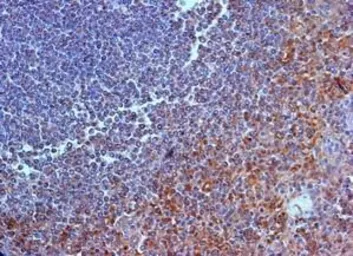 Anti-IL23 Receptor antibody, N-term used in IHC (Paraffin sections) (IHC-P). GTX39947