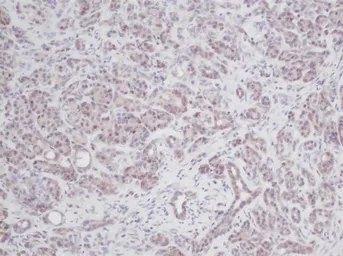 Anti-IL2 antibody used in IHC (Paraffin sections) (IHC-P). GTX39952