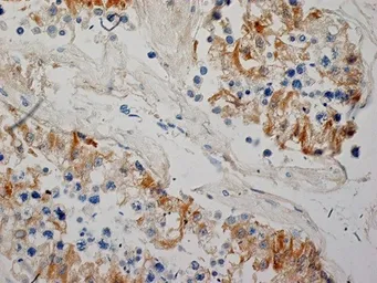 Anti-Inhibin alpha antibody [R1] used in IHC (Paraffin sections) (IHC-P). GTX40215