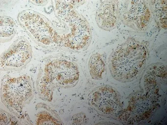 Anti-Inhibin alpha antibody [R1] used in IHC (Paraffin sections) (IHC-P). GTX40215