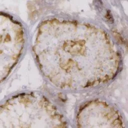 Anti-Inhibin alpha antibody [R1] used in IHC (Paraffin sections) (IHC-P). GTX40215