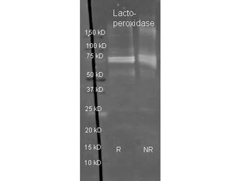 Anti-Lactoperoxidase antibody (HRP) used in Western Blot (WB). GTX40571
