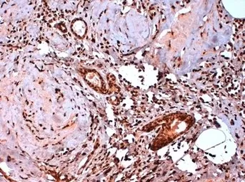 Anti-Estrogen Receptor beta 5 antibody [5/25] used in IHC (Paraffin sections) (IHC-P). GTX41209