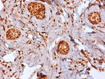 Anti-Estrogen Receptor beta 2 antibody [57/3] used in IHC (Paraffin sections) (IHC-P). GTX41213