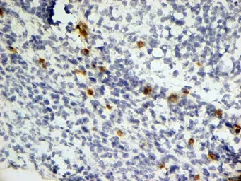 Anti-Dectin-1 antibody [2A11] (Low endotoxin, azide free) used in IHC (Frozen sections) (IHC-Fr). GTX41471