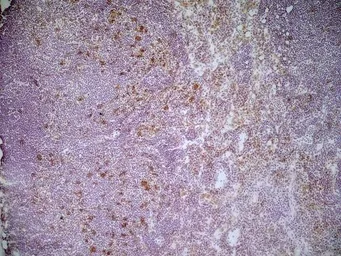 Anti-CD68 antibody [FA-11] used in IHC (Frozen sections) (IHC-Fr). GTX41866