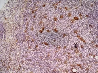 Anti-CD68 antibody [FA-11] used in IHC (Frozen sections) (IHC-Fr). GTX41866