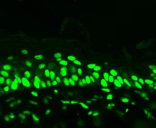 Anti-Acetyl Lysine antibody [7F8] used in IHC (Paraffin sections) (IHC-P). GTX41978