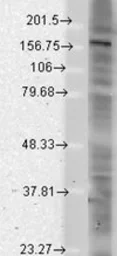 Anti-PAN-SHANK antibody [S23b-49] used in Western Blot (WB). GTX42006