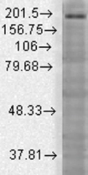 Anti-SHANK3 antibody [S69-46] used in Western Blot (WB). GTX42015