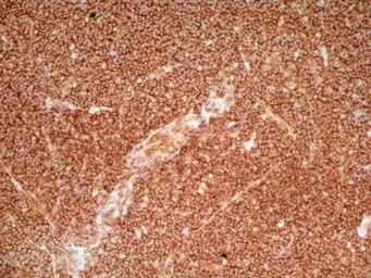 Anti-CD36 antibody [SMØ] used in IHC (Frozen sections) (IHC-Fr). GTX42050