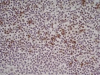 Anti-NKG2D antibody [1D11] used in IHC (Frozen sections) (IHC-Fr). GTX42086