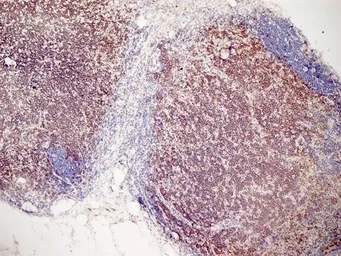Anti-CD3 antibody [KT3] used in IHC (Frozen sections) (IHC-Fr). GTX42104
