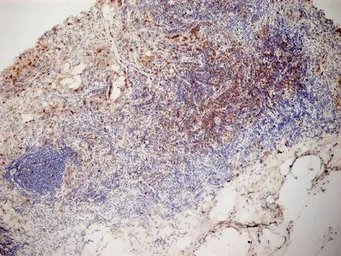 Anti-CD3 antibody [KT3] used in IHC (Frozen sections) (IHC-Fr). GTX42105