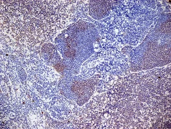 Anti-CD3 antibody [KT3] used in IHC (Frozen sections) (IHC-Fr). GTX42105