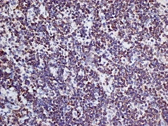 Anti-CD3 antibody [KT3] (Low endotoxin, azide free) used in IHC (Frozen sections) (IHC-Fr). GTX42108