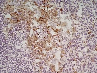 Anti-Mannose Receptor antibody [MR5D3] used in IHC (Frozen sections) (IHC-Fr). GTX42263
