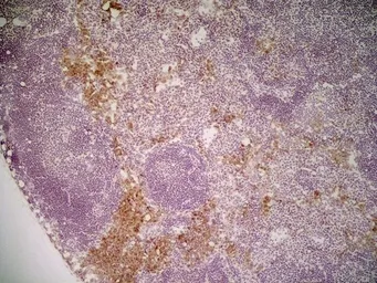 Anti-Mannose Receptor antibody [MR5D3] used in IHC (Frozen sections) (IHC-Fr). GTX42263