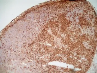 Anti-CD169 antibody [ED3] used in IHC (Frozen sections) (IHC-Fr). GTX42356