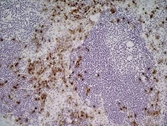 Anti-CD169 antibody [3D6.112] used in IHC (Frozen sections) (IHC-Fr). GTX42363