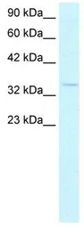 Anti-HEY1 antibody, C-term used in Western Blot (WB). GTX42614