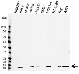 Anti-beta 2 Microglobulin antibody [2213] used in Western Blot (WB). GTX42680