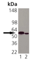 Anti-Calreticulin antibody [FMC 75] used in Western Blot (WB). GTX42683
