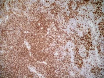Anti-CD4 antibody [OX-35] used in IHC (Frozen sections) (IHC-Fr). GTX44519