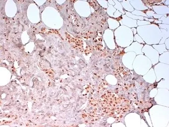 Anti-N-Cadherin antibody [13A9] used in IHC (Paraffin sections) (IHC-P). GTX44601