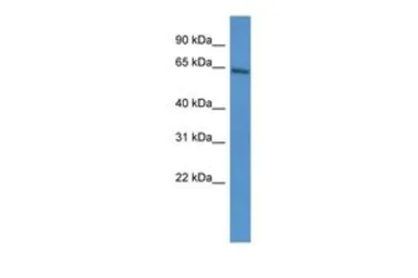 Anti-ARNTL2 antibody, C-term used in Western Blot (WB). GTX44613