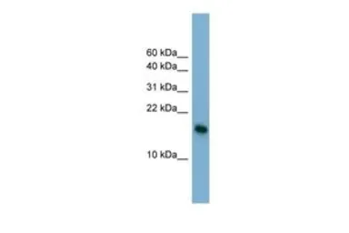 Anti-BATF3 antibody, N-term used in Western Blot (WB). GTX44669