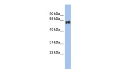 Anti-KRT75 antibody, Internal used in Western Blot (WB). GTX44816