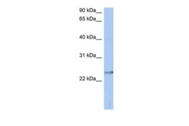 Anti-ATP6V1E2 antibody, Internal used in Western Blot (WB). GTX44838