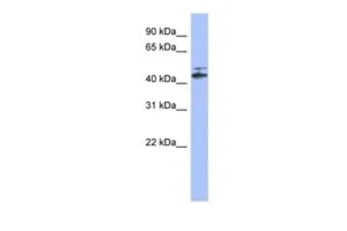 Anti-CYP20A1 antibody, N-term used in Western Blot (WB). GTX44873