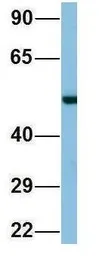 Anti-TINAGL1 antibody, Internal used in Western Blot (WB). GTX44884