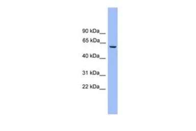 Anti-NAP1L2 antibody, Internal used in Western Blot (WB). GTX44895