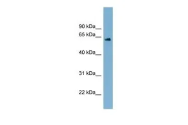 Anti-C12ORF4 antibody, Internal used in Western Blot (WB). GTX44918