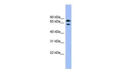 Anti-PANK4 antibody, Internal used in Western Blot (WB). GTX44962