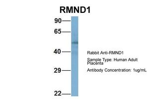 Ритм rmd1 датчик