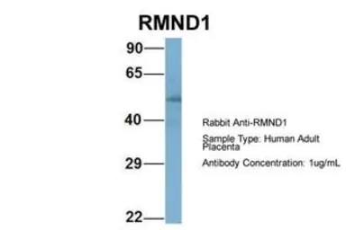 Anti-RMND1 antibody, Internal used in Western Blot (WB). GTX44985