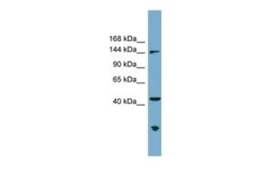 Anti-ERCC6L antibody, N-term used in Western Blot (WB). GTX44993