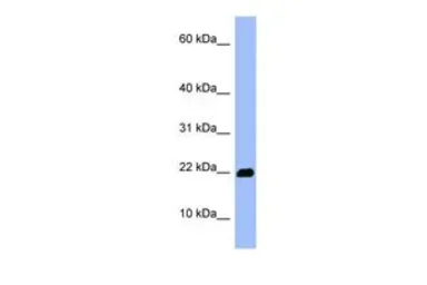 Anti-OMP antibody, Internal used in Western Blot (WB). GTX45044