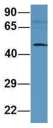 Anti-MFAP1 antibody, Internal used in Western Blot (WB). GTX45045