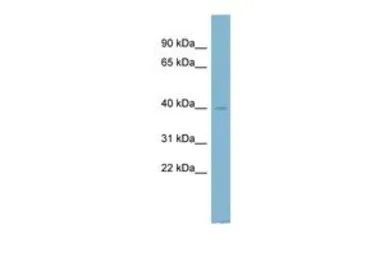 Anti-NDUFA9 antibody, N-term used in Western Blot (WB). GTX45048