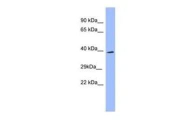 Anti-SH3GL2 antibody, N-term used in Western Blot (WB). GTX45053