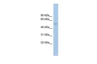 Anti-ANKRD13D antibody, Internal used in Western Blot (WB). GTX45138