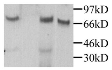 Anti-MPEG1 antibody used in Western Blot (WB). GTX45146