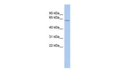 Anti-LRRTM1 antibody, Internal used in Western Blot (WB). GTX45194