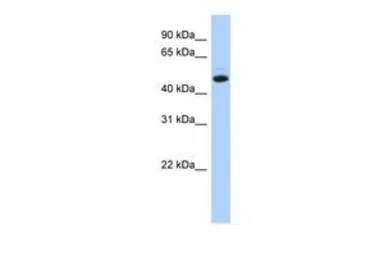 Anti-C5ORF36 antibody, N-term used in Western Blot (WB). GTX45226